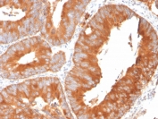 Immunohistochemistry analysis of SLAMF7/CS1 antibody in human spleen tissue. Formalin-fixed, paraffin-embedded human spleen shows membranous and cytoplasmic brown staining in scattered lymphoid cells consistent with SLAMF7-positive immune cell populations. Background staining is minimal. Heat induced epitope retrieval was performed by boiling sections in pH 9 10mM Tris with 1mM EDTA buffer for 20 minutes followed by cooling prior to incubation with SLAMF7 antibody.
