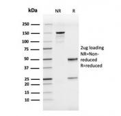 SDS-PAGE analysis of purified, BSA-free recombinant CD50 antibody (clone rICAM3/1019) as confirmation of integrity and purity.