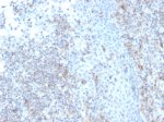 CD50 Antibody rICAM3/1019 in Human Tonsil IHC. Immunohistochemistry staining of FFPE human tonsil tissue with CD50 Antibody, clone rICAM3/1019. Tissue sections underwent HIER by boiling in 10 mM Tris with 1 mM EDTA, pH 9, for 20 min followed by cooling before testing. The image shows positive staining among lymphoid cells, with heterogeneous staining intensity across the tissue. This pattern is consistent with detection of the leukocyte-associated LFA-1 Ligand CD50 in human tonsil.