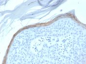 Kallikrein 5 Antibody Epidermis IHC. Immunohistochemistry analysis of FFPE human skin tissue stained with Kallikrein 5 Antibody demonstrates strong linear and cytoplasmic HRP-DAB brown staining within the superficial epidermal keratinocyte layer, consistent with KLK5-associated serine protease expression involved in epidermal barrier regulation and skin desquamation pathways. This kallikrein family protease antibody highlights epithelial differentiation-associated signaling and cutaneous barrier homeostasis within stratified squamous epithelium.