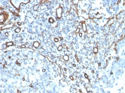 Immunohistochemistry of Collagen IV antibody in human tonsil. Formalin-fixed, paraffin-embedded human tonsil tissue was stained using a rabbit monoclonal COL4/4241R, Collagen IV antibody. Heat induced epitope retrieval was performed by boiling tissue sections in 10mM Tris with 1mM EDTA, pH 9, for 20 min followed by cooling prior to staining. HRP-DAB brown chromogenic signal highlights vascular basement membranes and stromal extracellular matrix structures, outlining small blood vessels and reticular frameworks consistent with Collagen type IV localization.