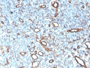 IHC staining of FFPE human tonsil with Collagen IV antibody rabbit monoclonal clone COL4/4241R. HIER: boil tissue sections in pH 9 10mM Tris with 1mM EDTA for 20 min and allow to cool before testing.