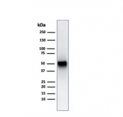 PD-ECGF Antibody Spleen WB. Western blot analysis of human spleen tissue lysate using PD-ECGF antibody detecting thymidine phosphorylase (TYMP), clone rTYMP/3444. A band is detected at approximately 50-55 kDa, consistent with the predicted molecular weight of TYMP. The observed signal in lymphoid tissue aligns with expression of PD-ECGF as a cytosolic enzyme and angiogenesis-associated factor involved in nucleotide metabolism and vascular signaling.