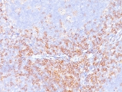 CD4 Antibody for IHC. Analysis of CD4 antibody staining in FFPE human tonsil tissue shows strong membranous labeling of CD4-positive T helper lymphocytes within interfollicular regions and surrounding lymphoid follicles, highlighting T cell-rich zones within lymphoid tissue. The selective staining pattern supports the high specificity profile of this microarray specificity validated clone CD4/3619R. Heat-induced epitope retrieval was performed by boiling tissue sections in pH 9 10 mM Tris with 1 mM EDTA for 20 minutes followed by cooling before testing.