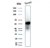 Western blot testing of human tonsil tissue lysate with recombinant CD4 antibody. Expected molecular weight: 50-55 kDa.