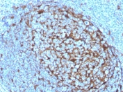 Cystatin A Antibody Lymphoid Tissue IHC. Immunohistochemistry of Cystatin A / CSTA in FFPE human tonsil tissue using mouse monoclonal Cystatin A antibody, clone CSTA/3553. HRP-DAB brown staining highlights cytoplasmic labeling within epithelial components of tonsillar crypt regions, while surrounding lymphoid cells show lower staining, consistent with epithelial-associated expression of this intracellular protease inhibitor, and nuclei are counterstained blue. Heat induced epitope retrieval was performed by boiling tissue sections in pH 9 10 mM Tris with 1 mM EDTA for 20 min followed by cooling prior to staining.