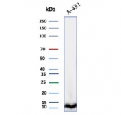 Cystatin A Antibody A431 WB. Western blot analysis of Cystatin A / CSTA in human A431 cell lysate using mouse monoclonal Cystatin A antibody, clone CSTA/3553. A band is detected at approximately 11 kDa, consistent with the predicted molecular weight of CSTA, supporting detection of this intracellular cysteine protease inhibitor in epithelial-derived cells.