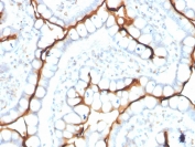 ACE Antibody Human Small Intestine Immunohistochemistry. IHC staining of FFPE human small intestine with ACE antibody. HIER: boil tissue sections in pH 9 10mM Tris with 1mM EDTA for 20 min and allow to cool before testing.