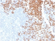 IHC staining of FFPE human thymus with TdT antibody mouse monoclonal. HIER: boil tissue sections in pH 9 10mM Tris with 1mM EDTA for 20 min and allow to cool before testing.
