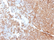 IHC staining of FFPE human thymus with TdT antibody mouse monoclonal. HIER: boil tissue sections in pH 9 10mM Tris with 1mM EDTA for 20 min and allow to cool before testing.