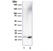 FABP1 Antibody HepG2 and Kidney WB. Western blot analysis of human 1) HepG2 and 2) kidney lysates using FABP1 antibody. A band is detected at approximately 14 kDa, consistent with the predicted molecular weight of Fatty acid-binding protein 1 / FABP1. Enhanced signal in HepG2 cells is consistent with the known enrichment of this intracellular fatty acid-binding and lipid transport protein in hepatocyte-derived cells.