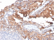 Fibronectin Antibody Human Tonsil Tissue IHC. Immunohistochemistry staining of FFPE human tonsil with Fibronectin antibody (clone C6F10). HIER: boil tissue sections in pH 9 10mM Tris with 1mM EDTA for 20 min and allow to cool before testing.