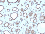 DBC2 Antibody Human Thyroid Immunohistochemistry. IHC staining of FFPE human thyroid with DBC2 antibody. HIER: boil tissue sections in pH 9 10mM Tris with 1mM EDTA for 20 min and allow to cool before testing.