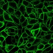 Endoglin Antibody HeLa IF. Immunofluorescence analysis of PFA-fixed human HeLa cells using Endoglin Antibody (green) demonstrates prominent membranous staining outlining cell borders, consistent with CD105 / Endoglin expression as a cell surface angiogenesis-associated marker.