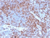 CD22 Antibody Human Tonsil IHC. Immunohistochemistry analysis of CD22/Siglec-2 expression in FFPE human tonsil tissue using recombinant CD22 Antibody / B Cell Receptor Signaling Regulator Antibody clone BLCAM/2637R. Strong HRP-DAB brown membranous and cytoplasmic staining is observed in germinal center and mantle zone B lymphocytes, highlighting dense B cell populations involved in antigen-driven immune responses, while surrounding stromal and non-lymphoid cells remain largely negative. The staining pattern reflects CD22 function as a regulator of B cell receptor signaling and supports use of this CD22 antibody for immunohistochemistry-based evaluation of B cell activation and signaling context in lymphoid tissues. Heat-induced epitope retrieval was performed in pH 9 Tris-EDTA buffer for 20 minutes followed by cooling prior to antibody incubation.