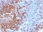 CD22 Antibody Human Spleen IHC. Immunohistochemistry analysis of CD22/Siglec-2 expression in FFPE human spleen tissue using CD22 Antibody / B Cell Receptor Signaling Regulator Antibody clone BLCAM/2637R. Strong HRP-DAB brown staining is localized to B lymphocyte-rich regions within the white pulp, with prominent membranous and cytoplasmic signal highlighting follicular B cell populations, while surrounding red pulp and non-lymphoid elements remain largely negative. The staining distribution is consistent with CD22-mediated regulation of B cell receptor signaling in splenic immune compartments and supports use of this CD22 antibody for immunohistochemistry-based assessment of lymphoid tissue organization and signaling context. Heat-induced epitope retrieval was performed in pH 9 Tris-EDTA buffer for 20 minutes followed by cooling prior to antibody incubation.