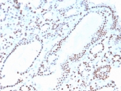 PAX8 Antibody Clone ZR-1 / Paired Box Protein Pax-8 Antibody immunohistochemistry in human thyroid tissue showing strong nuclear staining in follicular epithelial cells. The recombinant rabbit monoclonal antibody clone ZR-1 highlights nuclear localization consistent with Paired box protein Pax-8 (PAX8) expression in thyroid follicles. Staining is concentrated in follicular cell nuclei surrounding colloid-filled lumina, with minimal background, supporting its role as a thyroid lineage marker in normal tissue architecture. HIER: boil tissue sections in pH 9 10mM Tris with 1mM EDTA for 20 min and allow to cool before testing.