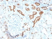 PAX8 Antibody Clone ZR-1 / Paired Box Protein Pax-8 Antibody immunohistochemistry in human kidney tissue showing distinct nuclear staining in renal tubular epithelial cells. The recombinant rabbit monoclonal antibody clone ZR-1 demonstrates strong nuclear localization consistent with Paired box protein Pax-8 (PAX8) expression in renal epithelium. Staining is prominent in tubular structures, with nuclei of epithelial cells clearly highlighted while surrounding stromal elements remain largely negative, supporting its role as a renal lineage marker. HIER: boil tissue sections in pH 9 10mM Tris with 1mM EDTA for 20 min and allow to cool before testing.