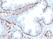 p40 Antibody. Immunohistochemistry analysis of Tumor protein p40 (deltaNp63) in FFPE human kidney tissue using a p40 antibody (clone rTP40/3690) demonstrates distinct HRP-DAB brown nuclear staining in epithelial cells lining tubular structures, while surrounding stromal and non-epithelial cells remain largely negative. The nuclear-restricted staining pattern is consistent with the localization of deltaNp63 as a transcription factor and highlights epithelial cell compartments within the kidney. Heat-induced epitope retrieval was performed by boiling tissue sections in pH 9 10mM Tris with 1mM EDTA for 20 minutes followed by cooling prior to antibody incubation.