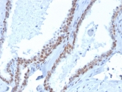 p40 Antibody Biotin Conjugate. Immunohistochemistry analysis of Tumor protein p40 (deltaNp63) in FFPE human prostate tissue using a p40 Antibody Biotin Conjugate (clone rTP40/3690) demonstrates strong HRP-DAB brown nuclear staining in basal epithelial cells lining glandular structures, while luminal secretory cells remain negative. The staining forms a continuous basal layer pattern outlining prostate glands, consistent with the known localization of deltaNp63 in basal cell compartments. The biotin-streptavidin detection system enhances signal intensity, resulting in crisp nuclear staining with clear contrast against surrounding stromal tissue. This pattern supports accurate identification of basal cell populations and epithelial organization within prostate tissue. Heat-induced epitope retrieval was performed by boiling tissue sections in pH 9 10mM Tris with 1mM EDTA for 20 minutes followed by cooling prior to antibody incubation.