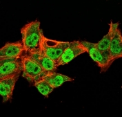 p40 Antibody for IF. Immunofluorescence analysis of PFA-fixed and permeabilized human HeLa cells using a p40 Antibody for IF (clone TP40/3980R) demonstrates strong green nuclear staining corresponding to Tumor protein p40 (deltaNp63), while Phalloidin (red) highlights actin cytoskeletal structures in the cytoplasm. The fluorescence signal is confined to nuclei, showing clear subcellular localization of deltaNp63 as a transcription factor, with minimal cytoplasmic background. The sharp nuclear definition and strong signal intensity are consistent with high-affinity binding of the recombinant rabbit monoclonal antibody, enabling precise visualization of p40-positive cells. The distinct separation between nuclear p40 signal and cytoskeletal staining supports accurate interpretation of epithelial cell identity and intracellular organization in immunofluorescence-based imaging.