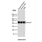 Recombinant Annexin A1 Antibody Human A549 Lung Cancer Cell and Tissue WB. Western blot analysis of human intestine, human lung and A549 lung cancer cell lysates using Recombinant Annexin A1 Antibody (clone rANXA1/4310). Annexin A1 is detected across the samples tested, demonstrating recognition of the target in human tissues and A549 lung cancer cells.