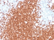 CD22 Antibody Spleen B-Cell Staining. Immunohistochemistry analysis of CD22/Siglec-2 expression in FFPE human spleen tissue using CD22 Antibody / B Cell Adhesion and Homing Marker Antibody clone rBLCAM/4108. Strong HRP-DAB brown membranous and cytoplasmic staining is concentrated within white pulp lymphoid follicles, highlighting dense B lymphocyte populations involved in cell-cell interactions and tissue localization, while surrounding red pulp regions and non-lymphoid cells show minimal staining. The distribution pattern aligns with CD22-mediated adhesion and homing functions that regulate B cell positioning within splenic microenvironments and supports use of this CD22 antibody for immunohistochemistry-based analysis of lymphoid architecture. Heat-induced epitope retrieval was performed in pH 9 Tris-EDTA buffer for 20 minutes followed by cooling prior to antibody incubation.