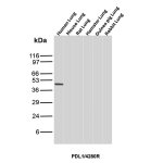 Recombinant PD-L1 Antibody in Multi-Species Lung WB. Western blot testing of Recombinant PD-L1 Antibody in lung tissue lysates from human, mouse, rat, hamster, guinea pig and rabbit. A prominent band is detected in the human lung sample at approximately 45 kDa, consistent with the extensively glycosylated mature form of PD-L1/CD274. Little to no corresponding signal is observed in the other species under the tested conditions. This Recombinant PD-L1 Antibody demonstrates strong detection of human PD-L1 with minimal cross-reactivity in the tested non-human lung samples.