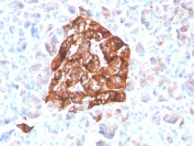 Synaptophysin Antibody Recombinant Rabbit MAb Clone SYP/4503R. Immunohistochemistry analysis of FFPE human pancreas tissue shows strong cytoplasmic HRP-DAB brown staining in pancreatic islet cells, consistent with Synaptophysin (SYP) localization in neuroendocrine secretory vesicles. Positive staining highlights endocrine cells within the islets of Langerhans, while surrounding exocrine pancreatic tissue shows minimal staining. Hematoxylin counterstain marks nuclei in blue. The recombinant rabbit monoclonal Synaptophysin antibody clone SYP/4503R was used to detect synaptic vesicle protein expression in human pancreatic neuroendocrine cells. Heat-induced epitope retrieval was performed by boiling tissue sections in pH 9 10mM Tris with 1mM EDTA for 20 minutes followed by cooling prior to staining.