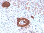 Synaptophysin Antibody Recombinant Mouse MAb Clone rSYP/4654. Immunohistochemistry analysis of FFPE human pancreas tissue shows strong cytoplasmic HRP-DAB brown staining in pancreatic islet cells, consistent with Synaptophysin (SYP) localization in neuroendocrine secretory vesicles. Positive staining highlights endocrine cells within the islets of Langerhans, while surrounding exocrine pancreatic tissue shows minimal staining. Hematoxylin counterstain marks nuclei in blue. The recombinant mouse monoclonal Synaptophysin antibody clone rSYP/4654 was used to detect synaptic vesicle protein expression in human pancreatic neuroendocrine cells. Heat-induced epitope retrieval was performed by boiling tissue sections in pH 9 10mM Tris with 1mM EDTA for 20 minutes followed by cooling prior to staining.