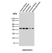 Recombinant AMACR Antibody Kidney Tissue WB. Western blot analysis of human, mouse, rat, hamster, and guinea pig kidney tissue lysates using Recombinant AMACR Antibody clone rAMACR/4674 demonstrates a consistent band at approximately 42 kDa, corresponding to the predicted molecular weight of Alpha-methylacyl-CoA racemase / AMACR. The conserved banding pattern across multiple species supports recognition of AMACR, a peroxisomal and mitochondrial metabolic enzyme involved in branched-chain fatty acid and bile acid metabolism.