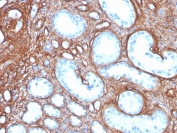 Immunohistochemistry of COL4A antibody in human kidney tissue. Formalin-fixed, paraffin-embedded human kidney was stained using recombinant mouse monoclonal COL4A antibody (clone rCOL4/4742). Heat induced epitope retrieval was performed by boiling tissue sections in 10mM Tris with 1mM EDTA, pH 9, for 20 min followed by cooling prior to staining. Strong HRP-DAB brown chromogenic signal outlines glomerular capillary loops and tubular basement membranes, demonstrating the characteristic linear extracellular staining pattern of Collagen type IV within renal tissue.