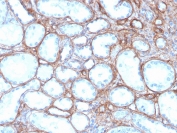 IHC staining of FFPE human kidney with COL4A antibody recombinant mouse mAb. HIER: boil tissue sections in pH 9 10mM Tris with 1mM EDTA for 20 min and allow to cool before testing.