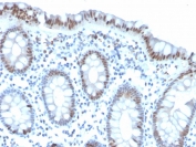 IHC staining of FFPE human colon with PHH3 antibody. HIER: boil tissue sections in pH 9 10mM Tris with 1mM EDTA for 20 min and allow to cool before testing.