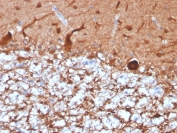 PGP9.5 Antibody / Neuronal Structure Marker Antibody. Immunohistochemistry analysis of PGP9.5 / UCHL1 in FFPE human cerebellum. Immunohistochemical staining of FFPE human cerebellum using PGP9.5 Antibody / Neuronal Structure Marker Antibody reveals extensive HRP-DAB brown cytoplasmic labeling of neuronal elements, with signal distributed along neuritic extensions and axonal fibers. The staining pattern emphasizes the layered organization of cerebellar tissue, with dense networks of nerve fibers forming a continuous mesh-like architecture and clear visualization of neuronal morphology. Clone UCHL1/4556R supports detailed assessment of neurite organization and neural tissue structure while non-neuronal regions remain largely unstained.