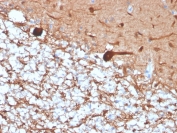 PGP9.5 Antibody / Neuroendocrine Tumor Marker Antibody. Immunohistochemistry analysis of PGP9.5 / UCHL1 in FFPE human cerebellum. Immunohistochemical staining of FFPE human cerebellum using PGP9.5 Antibody / Neuroendocrine Tumor Marker Antibody shows robust HRP-DAB brown cytoplasmic signal in neuronal cell bodies and extensive neuritic networks, consistent with the neuroendocrine-linked expression of UCHL1. The staining pattern mirrors features commonly observed in neuroendocrine tumors, where PGP9.5 is used to identify tumor cells with neuroendocrine differentiation and lineage characteristics. Clone rUCHL1/4557 enables clear visualization of neuroendocrine-associated cellular morphology while surrounding non-neuronal cells display minimal background staining.