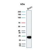 PGP9.5 Antibody / Neuroendocrine Tumor Marker Antibody for WB. Western blot analysis of PGP9.5 / UCHL1 in human brain lysate. Lane 1: human brain lysate. A band is detected at approximately 25 kDa, consistent with the predicted molecular weight of Protein gene product 9.5 / UCHL1. The strong signal observed in brain tissue reflects the high neuronal expression of this protein, which underlies its widespread use as a neuroendocrine tumor marker for identifying cells with neuroendocrine differentiation.