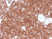CD4 Antibody for IHC. Analysis of CD4 antibody staining in FFPE human tonsil tissue shows strong membranous labeling of CD4-positive T helper lymphocytes within interfollicular regions and surrounding lymphoid follicles, highlighting T cell-rich zones within lymphoid tissue. This T Cell Activation Marker Antibody (clone rCD4/3930) demonstrates robust detection of activated T cell populations consistent with the functional role of CD4 in antigen-driven immune activation. Heat-induced epitope retrieval was performed by boiling tissue sections in pH 9 10 mM Tris with 1 mM EDTA for 20 minutes followed by cooling before testing.