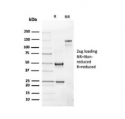 SDS-PAGE analysis of purified, BSA-free CD19 antibody as confirmation of integrity and purity.