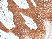 E-cadherin Antibody Human Cervix IHC. Immunohistochemistry analysis of Cadherin 1 / CDH1 expression in FFPE human cervix tissue using protein microarray validated clone CDH1/4398R antibody, showing strong membranous HRP-DAB brown staining in epithelial cells with clear cell-cell junction localization, while surrounding stromal cells remain largely negative. HIER: boil tissue sections in pH 9 10mM Tris with 1mM EDTA for 20 min and allow to cool before testing. Signal highlights epithelial layer organization and adherens junction integrity.