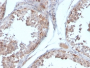 Follistatin Antibody / Activin Antagonist Antibody Human Testis IHC. Immunohistochemical staining of FFPE human testis tissue using Follistatin Antibody / Activin Antagonist Antibody (clone FST/4281). Follistatin expression is detected predominantly within the cytoplasm of seminiferous tubule cells, consistent with its role as a secreted activin antagonist that regulates spermatogenesis, reproductive function, and transforming growth factor beta signaling. Heat-induced epitope retrieval was performed by boiling tissue sections in pH 9, 10 mM Tris with 1 mM EDTA for 20 minutes and allowing them to cool prior to immunostaining.