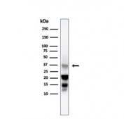 DAZL Antibody Testis WB. Western blot analysis of human testis lysate using DAZL Antibody / Germ Cell Marker Antibody (clone DAZL/4253) demonstrates a prominent immunoreactive band at approximately 30-35 kDa, consistent with expression of DAZL. DAZL is a conserved RNA-binding protein that regulates germline specification, germ cell differentiation, and reproductive development through post-transcriptional control of mRNA translation. Expression of DAZL is primarily associated with germ cell populations and developing reproductive tissues, making it a widely utilized marker of germline lineage commitment and fertility-associated pathways. The observed band migrates close to the predicted molecular weight of approximately 32 kDa and is consistent with endogenous DAZL expression in human testis tissue. Predicted molecular weight: approximately 32 kDa. Observed molecular weight: approximately 30-35 kDa.