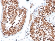 Inhibin alpha Antibody Mouse Monoclonal INHA/4265 IHC staining of human testis. Immunohistochemistry analysis of FFPE human testis tissue using Inhibin alpha Antibody Mouse Monoclonal INHA/4265 shows HRP-DAB brown cytoplasmic staining in cells within seminiferous tubules, consistent with Inhibin subunit alpha (INHA) expression in Sertoli cell populations, while surrounding stromal cells remain largely negative. HIER: tissue sections were boiled in pH 9 10mM Tris with 1mM EDTA for 20 minutes and allowed to cool before testing.