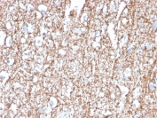 Immunohistochemistry analysis of MBP / Myelin Basic Protein antibody (clone MBP/4272) in human brain tissue. Formalin-fixed, paraffin-embedded human brain tissue was stained using MBP antibody (clone MBP/4272). Heat-induced epitope retrieval was performed by boiling tissue sections in 10mM Tris with 1mM EDTA, pH 9.0, for 20 minutes followed by cooling prior to antibody incubation. Strong cytoplasmic and fiber-like staining is observed throughout white matter regions, highlighting dense networks of myelinated axonal tracts, while neuronal cell bodies demonstrate minimal staining. The staining pattern is consistent with compact myelin distribution in central nervous system tissue.