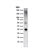 Western blot testing of human spleen lysate with TIM3 antibody. Expected molecular weight: 33-70 kDa depending on glycosylation level.