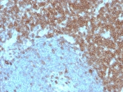 CD27 Antibody Specificity Validated IHC. Immunohistochemistry analysis of CD27 / TNFRSF7 expression in FFPE human tonsil tissue using HuProt Proteome-Wide Specificity Validated CD27 Antibody clone LPFS2/4179. Strong membranous HRP-DAB brown staining is observed in lymphocyte populations within tonsillar germinal centers and interfollicular regions, consistent with CD27 expression on activated and memory T and B cells, while surrounding non-lymphoid elements remain largely negative. The staining pattern supports selective target recognition across complex tissue environments and highlights immune cell compartmentalization within lymphoid tissue. Heat-induced epitope retrieval was performed in pH 9 10 mM Tris with 1 mM EDTA for 20 minutes followed by cooling prior to antibody incubation.