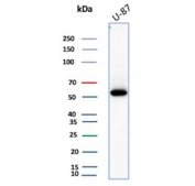 Vimentin Antibody / Cell Migration Marker Antibody WB. Western blot analysis of human U-87 MG cell lysate using Vimentin antibody detects a band at approximately 55 kDa, consistent with the predicted molecular weight of Vimentin (VIM). The rabbit monoclonal clone VIM/4388R shows a clear, single band, supporting detection of cytoskeletal components associated with migratory mesenchymal cells. The presence of Vimentin in U-87 MG cells aligns with its role in cytoskeletal organization linked to cell movement and invasive cellular behavior.
