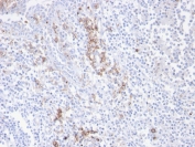 CD38 Antibody human tonsil tissue IHC. Immunohistochemistry analysis of CD38 / plasma cell marker expression in FFPE human tonsil using CD38 Antibody / Plasma Cell Marker Antibody. Strong membranous and cytoplasmic HRP-DAB brown staining highlights plasma cells within interfollicular regions, with scattered positive cells extending around germinal centers, consistent with antibody-secreting cell distribution. The staining pattern demonstrates clear identification of plasma cell populations with minimal background in surrounding lymphocytes. HIER was performed by boiling tissue sections in pH 9 10 mM Tris with 1 mM EDTA for 20 minutes followed by cooling prior to antibody incubation.