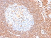 CD44 Antibody Tonsil Lymphoid Region IHC. Immunohistochemistry analysis of CD44 / CD44 antigen expression in FFPE human tonsil tissue using Cell Surface Receptor Signaling Antibody clone HCAM/4110R. Membrane-associated HRP-DAB brown staining is observed throughout lymphoid compartments, with prominent signal in surrounding cell populations and comparatively reduced staining in germinal center regions. This distribution highlights spatial variation in CD44 expression and supports its use for evaluating receptor localization and microenvironment-associated signaling patterns within tonsil tissue. Heat induced epitope retrieval was performed by boiling tissue sections in pH 9 10mM Tris with 1mM EDTA for 10-20 min followed by cooling at RT for 20 min.