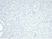 Negative: IHC staining of FFPE cat liver tissue with Nucleolin antibody (clone NCL/7014R). HIER: boil tissue sections in pH 9 10mM Tris with 1mM EDTA for 20 min and allow to cool before testing.